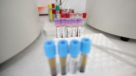Официално: В България няма случай на "Омикрон"