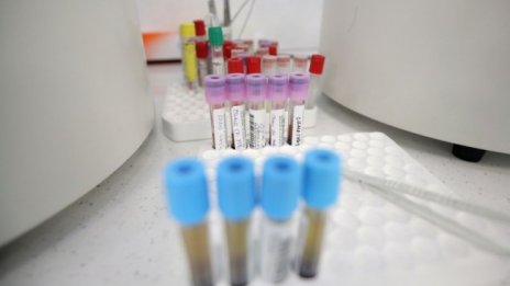 "Омикрон" вече е в България, всички болни са се върнали от чужбина 