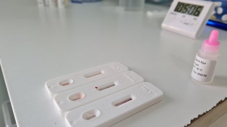 Откриха нов щам на ХИВ, разпространява се по-бързо