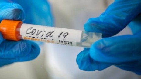 Д-р Рада Прокопова: Няма преболедувал COVID-19 без сърдечни нарушения