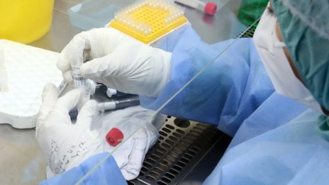 Откриха за първи път микропластмаса в човешка кръв