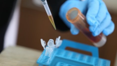 720 са новите случаи на коронавирус, 27 души са починали