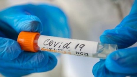 Няма нова симптомапика при новия подвариант на COVID-19