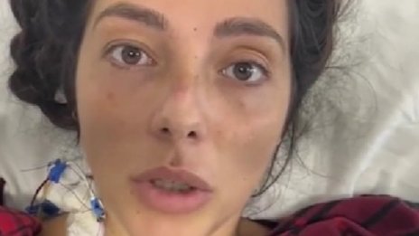 Албена, която пострада при ралито край Варна, има нужда от помощ за лечението си