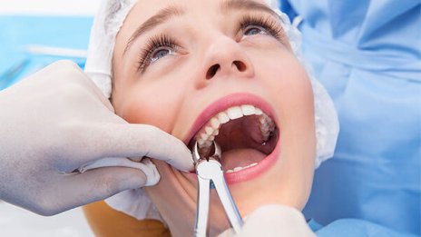 Затвор за дентални лекари, извадили 11 здрави зъба на пациентка