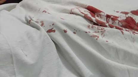 Самовзривил се уби поне още един човек в Сирия