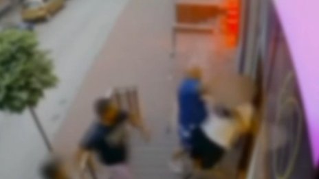 Мъж удари момче с камък в лицето, има счупени лицеви кости