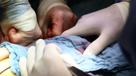 Първата трансплантация на свински черен дроб на човек направиха в Китай