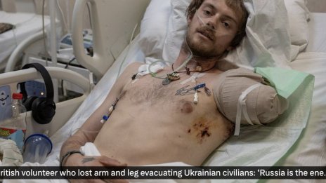 Британец загуби ръка и крак, евакуирайки украински цивилни