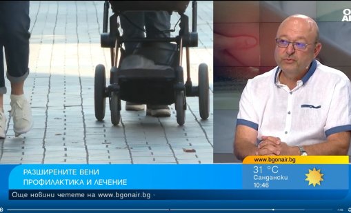 Съдов хирург: По-често разширените вени се срещат при жените