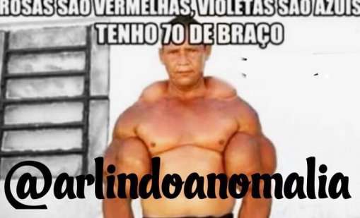 Почина "бразилският Попай", инжектирал минерално масло и алкохол в бицепсите си