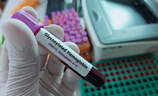 Нисък хемоглобин: Причини, симптоми и лечение