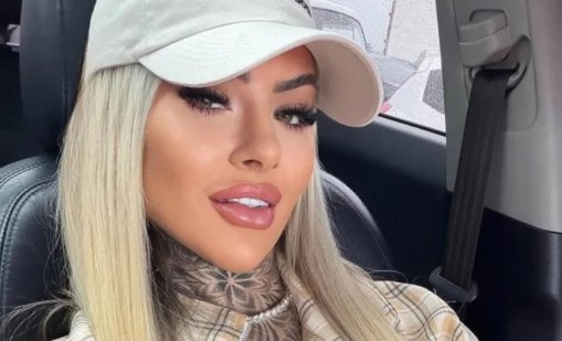 Само на 27 години: Инфлуенсърка почина след пластична операция