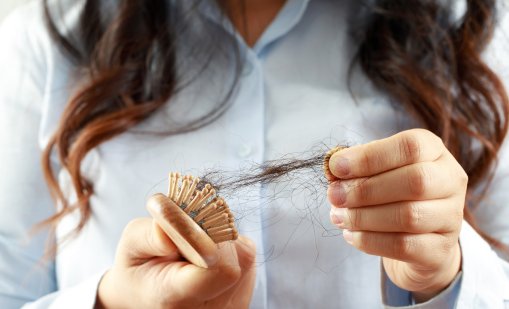 Признаци на хормонален косопад