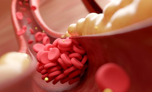 Природни решения срещу висок холестерол