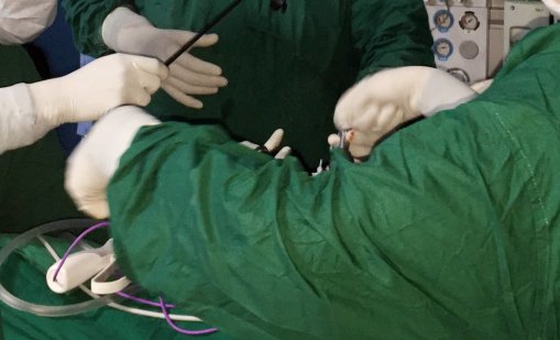 Почина момченцето от Неапол, на което беше трансплантирано увредено донорско сърце