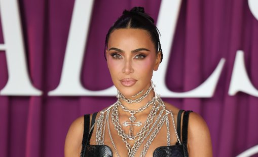 Ким Кардашиян има ниска мозъчна активност заради аневризмата
