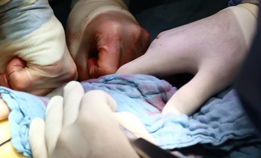 Първата трансплантация на свински черен дроб на човек направиха в Китай