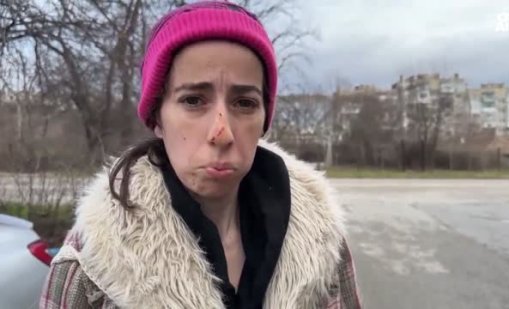 Жена е с множество ухапвания след нападение от овчарка в Казанлък