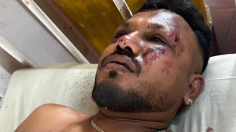 Британец е оцелял в самолетната катастрофа в Индия, скочил от самолета ВИДЕО