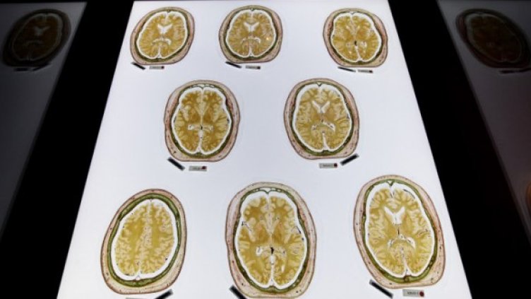 Снимка: Getty Images/Guliver Photos