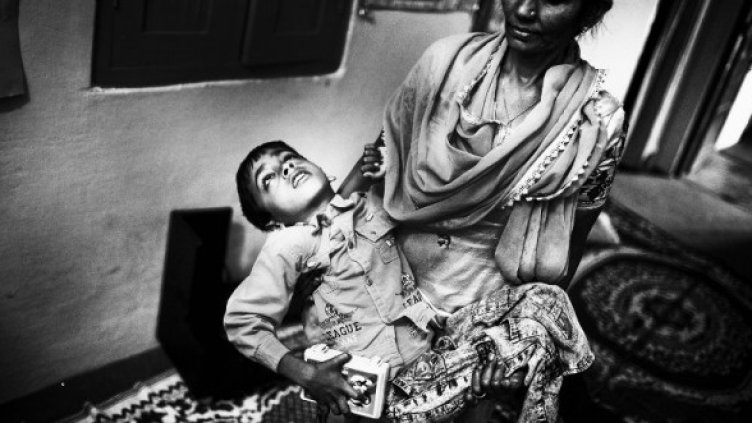 Последствията от катастрофата в Бхопал, Индия. Снимка: Getty Images/Guliver Photos