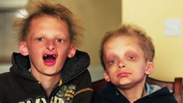 Саймън и Джордж. Снимка: Getty Images/Guliver Photos