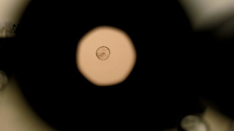 Снимка: Getty Images/Guliver Photos