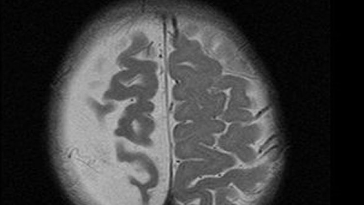 Снимка: Getty Images/Guliver Photos