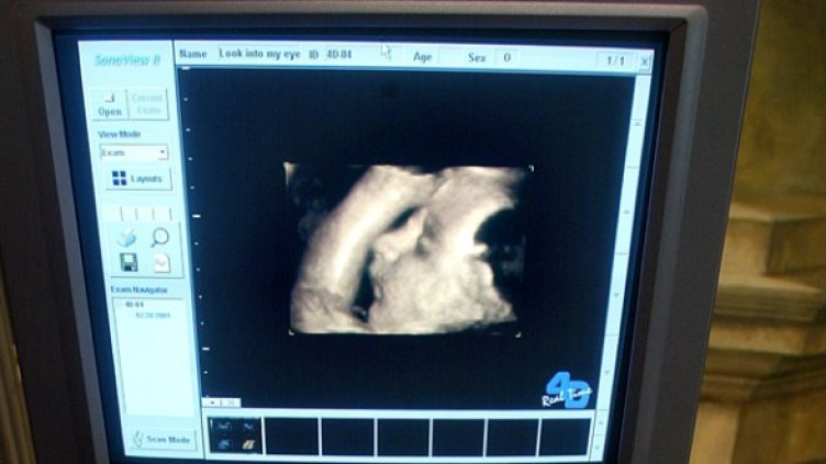 Снимка: Getty Images/Guliver Photos