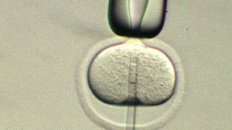 Снимка: Getty Images/Guliver Photos