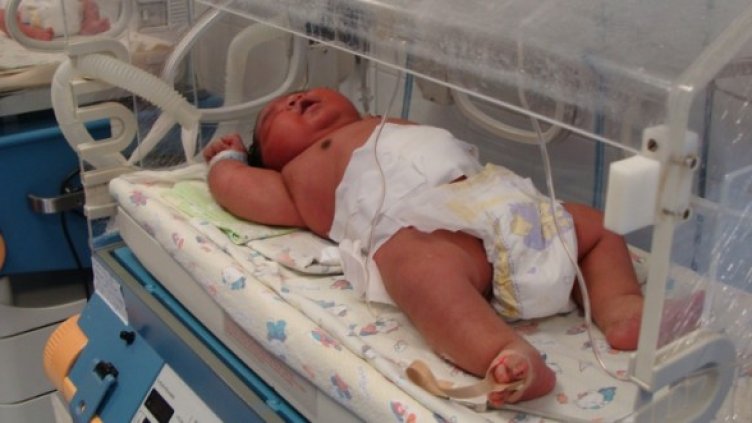 Снимка: МБАЛ-Бургас