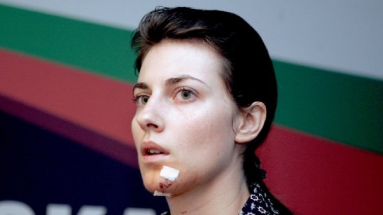 Пострадалата депутатка от "Атака" Деница Гаджева. Снимка: БТА