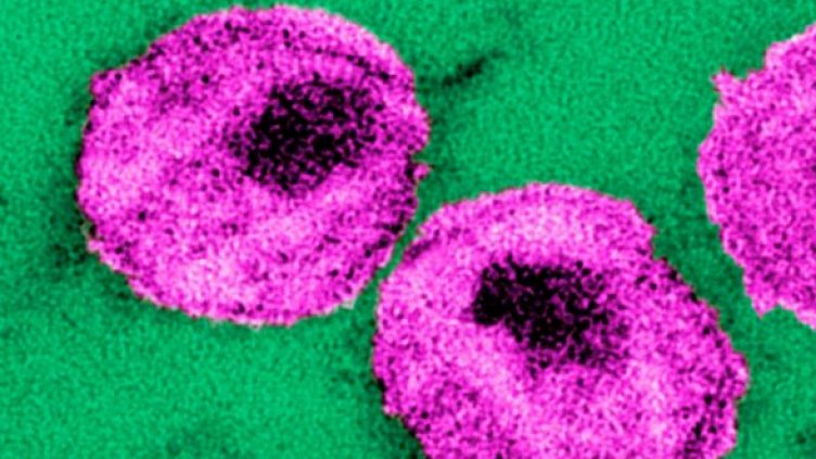 Благодарение на нови лекарства, които могат да контролират вируса в продължение на десетилетия 33,3 млн. души по целия свят се учат да живеят с ХИВ. Снимка: Reuters