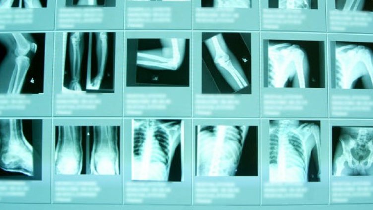 Снимка: Getty Images/Guliver Photos