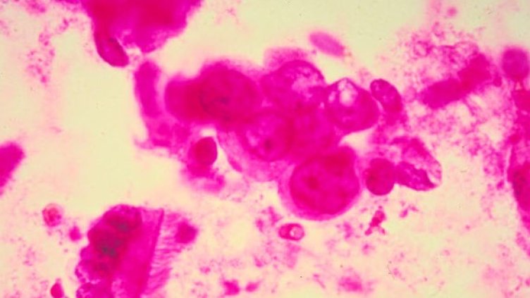 Снимка: Getty Images/Guliver Photos