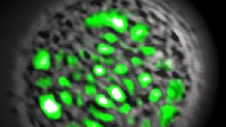 Изображение: Nature Photonics and Malte Gather, Wellman Center for Photomedicine, Mass. General Hospital