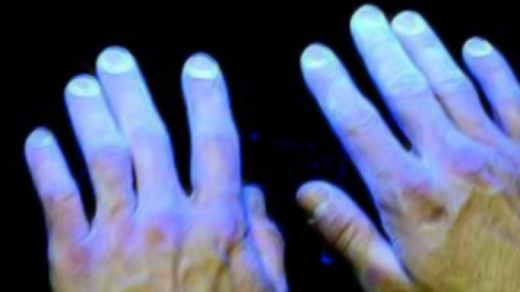 Снимка: glogerm.com