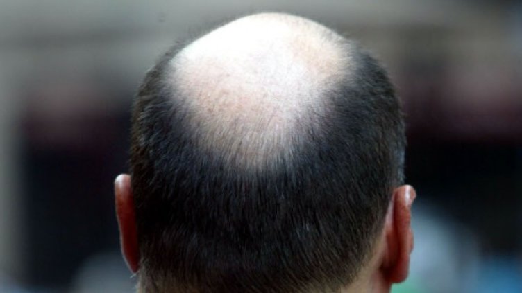 Снимка: Getty Images/Guliver Photos