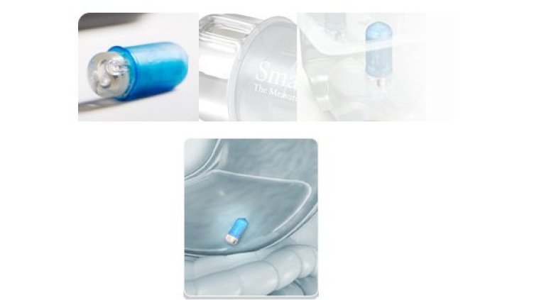 Изображение: SmartPill