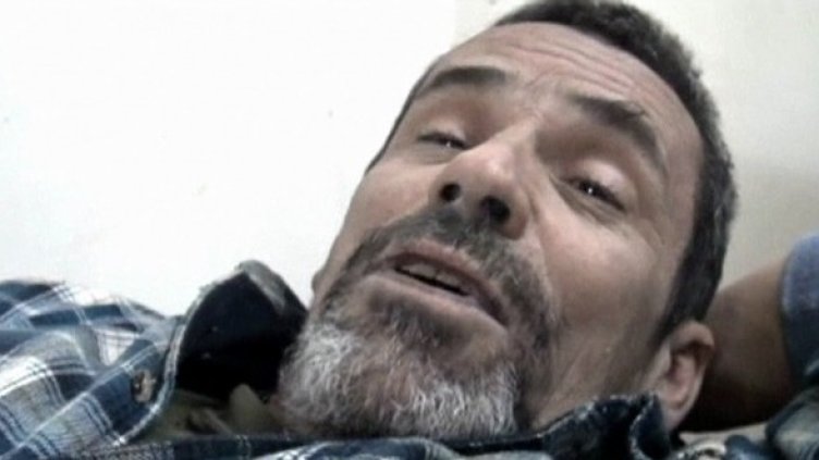 Раненият Пол Конрой. Снимка: Reuters