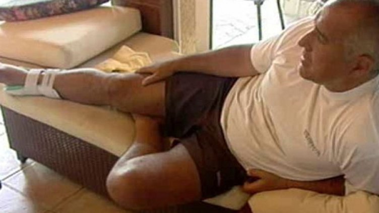 Бойко Борисов счупи крак през 2009 г. Снимка: bTV