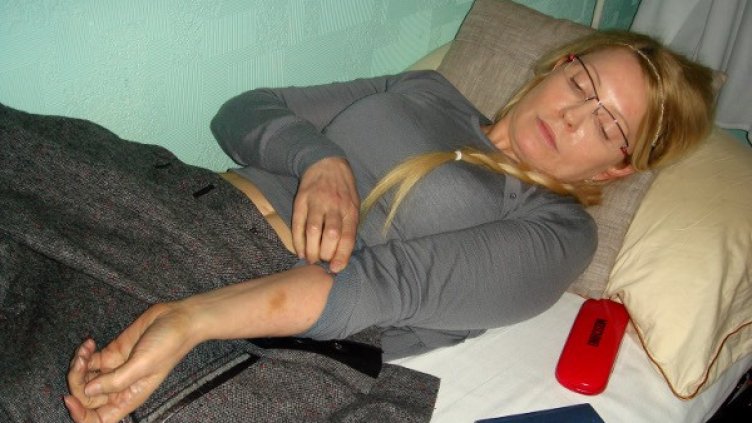 Тимошенко в затвора, където излежава 7-годишна присъда, показва следи от насилие. Reuters