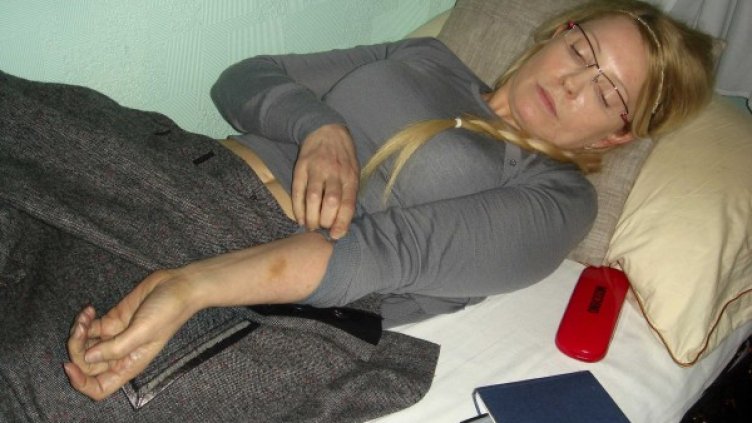 Тимошенко показва белези от наранявания по тялото й. Снимка: Reuters