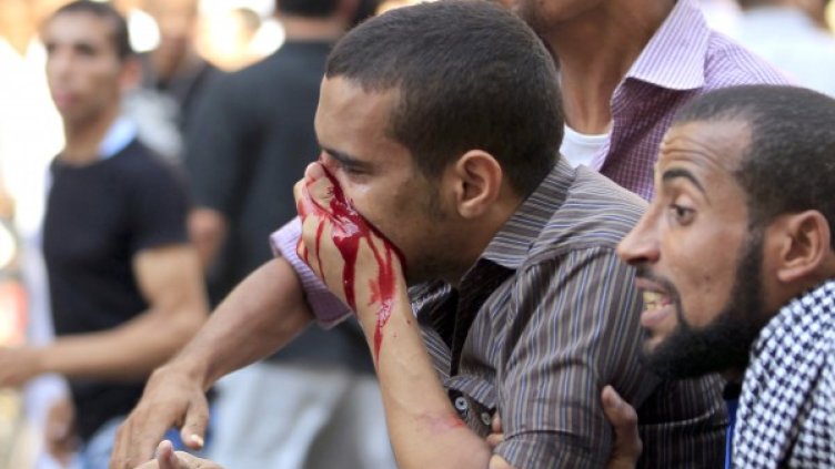 Стотици хора са ранени. Снимка: Reuters