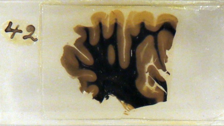 Парче от мозъка на Айнщайн. Снимка: Ройтерс