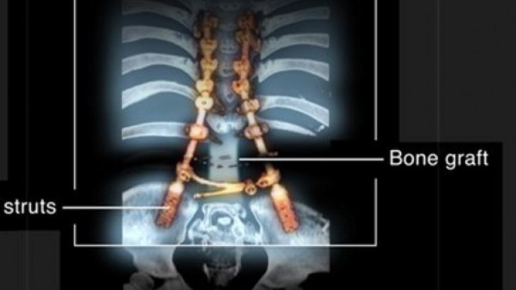 Снимка: Birmingham Children's Hospital