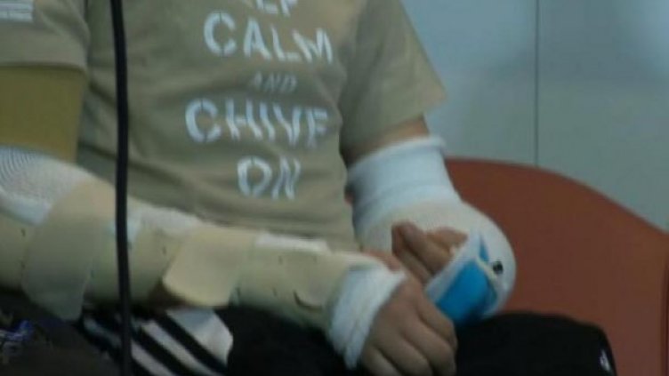 Щастлив съм, имам две нови ръце! 