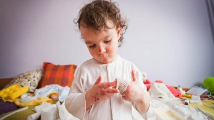 Запознайте се с малката Яна - тя е "пеперудено" дете 