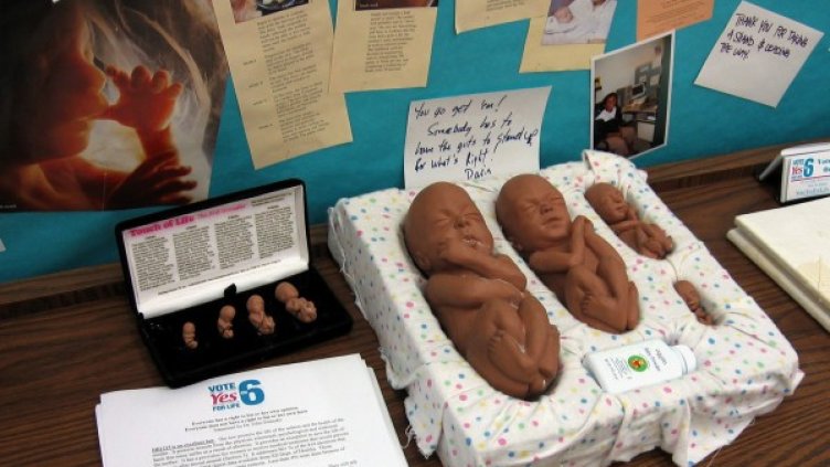 В Северна Дакота е в сила най-строгото законодателство за абортите в САЩ. Снимка: архив, Reuters